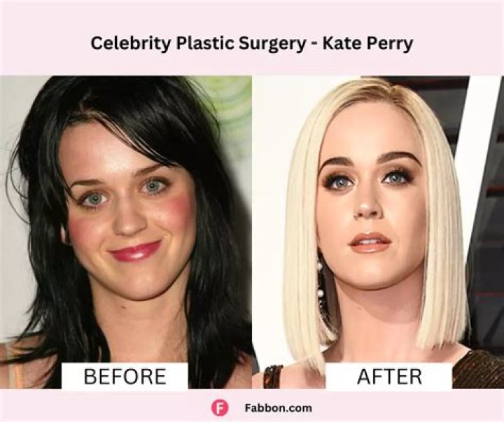 Christian Slater Plastic Surgery Before and After