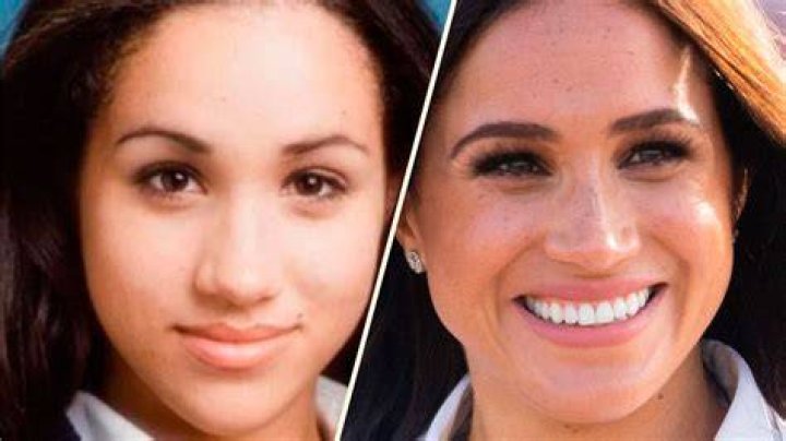 Did Alize Cornet Have Nose Job? Before And After Photos – Instagram ·