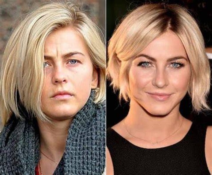 Julianne Hough Plastic Surgery Her Stunning Transformation