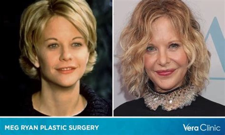 Meg Ryan reacts to plastic surgery, 'unrecognizable' comments ·