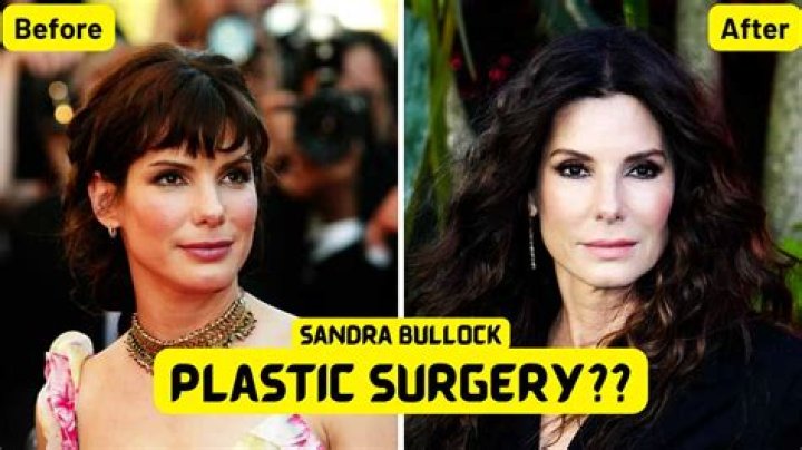 Sandra Bullock's Plastic Surgery Journey Revealed