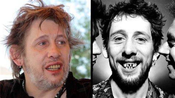 Shane Macgowan Teeth History