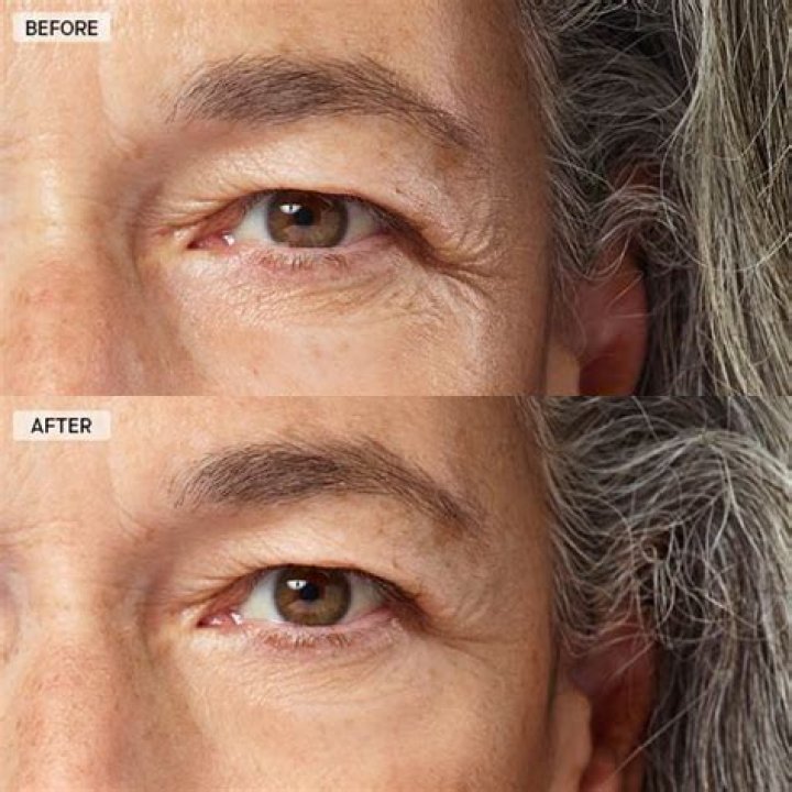 Uncover The Truth Behind Il Makiage Power ReDo Wrinkle Fix: Unlock Youthful Radiance