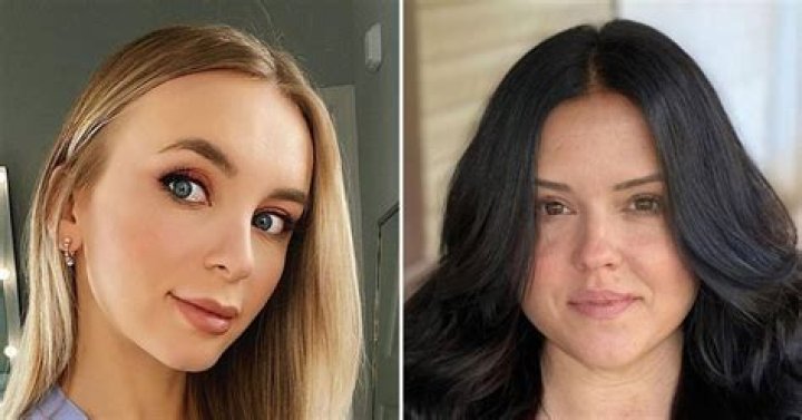 Yara, More Talk Plastic Surgery ·